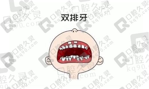 8岁孩子老牙没掉，为何新牙已出？