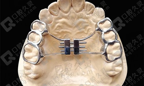 扩弓器矫正牙齿的大概多少钱？有牙齿矫正扩弓器图片能看一下吗？