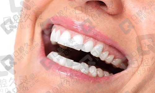 补牙后一般能维持几年？