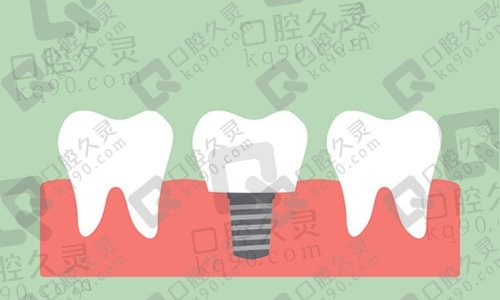 种植牙有什么风险和后遗症？