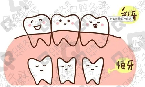 乳牙滞留必须拔掉吗？医生为什么一般不建议拔掉？