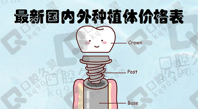 便宜哭了!一颗种植牙十分钟完成，全新种牙价格表公开,快来看价吧