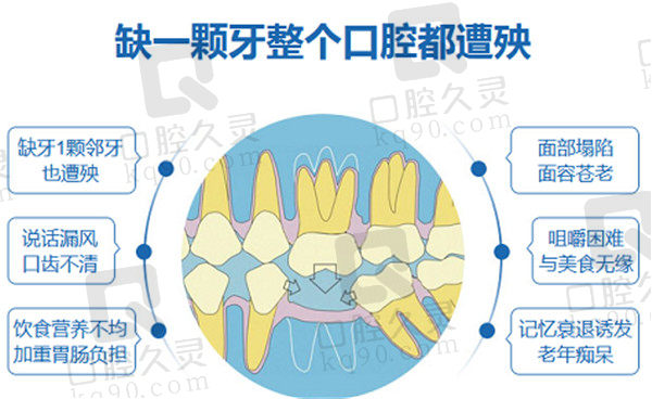 缺失牙带来的影响