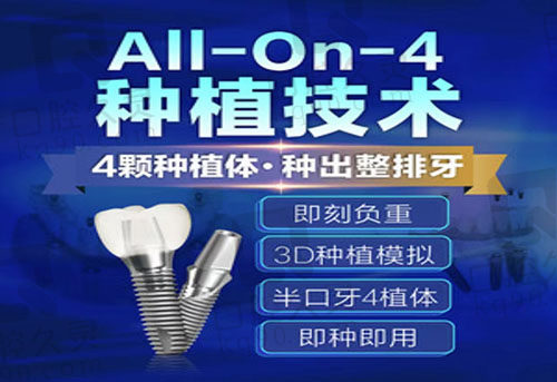 all-on-4种植技术