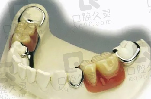 活动义齿模型示范图