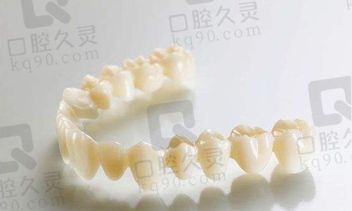 全瓷牙连桥冠