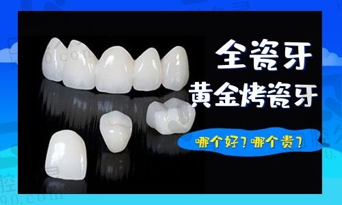 黄金烤瓷牙和全瓷牙哪个贵