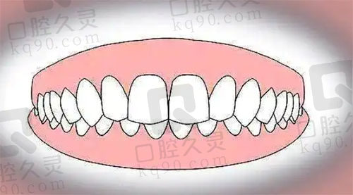 深覆合