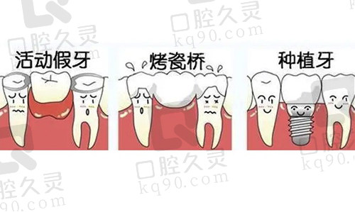 卡通镶牙过程图解