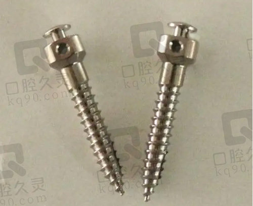 骨钉
