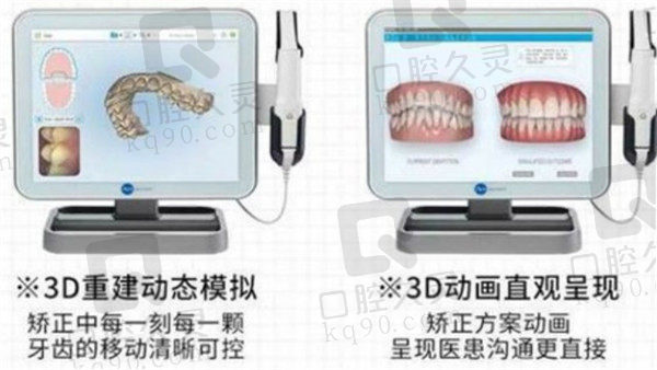 厦门登特口腔牙齿矫正设备优势