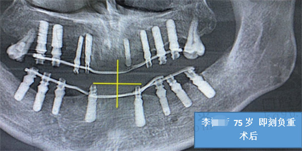 石家庄赵翠彩口腔实例1