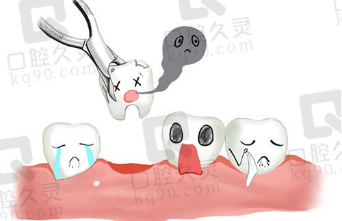 拔牙