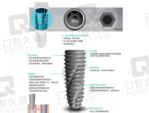 科威尔种植体简介