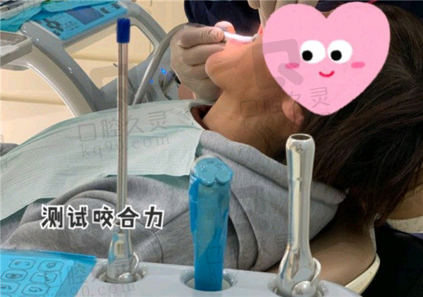北京固灵口腔种植牙测试咬合力