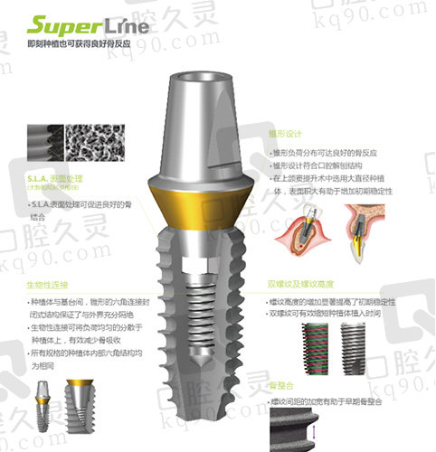 韩国登腾一代种植牙SuperLine