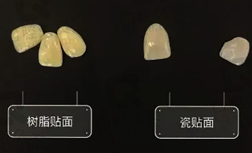 树脂贴面和瓷贴面对比