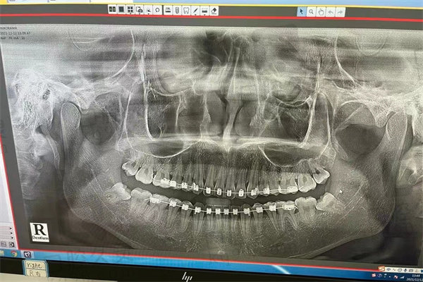 成都唯美口腔拍片