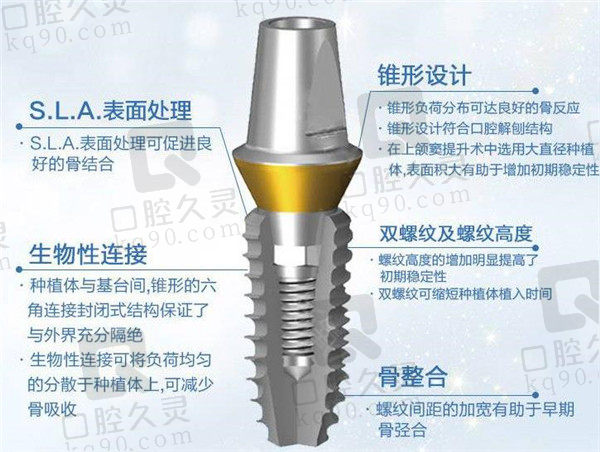 韩国登腾种植牙优势