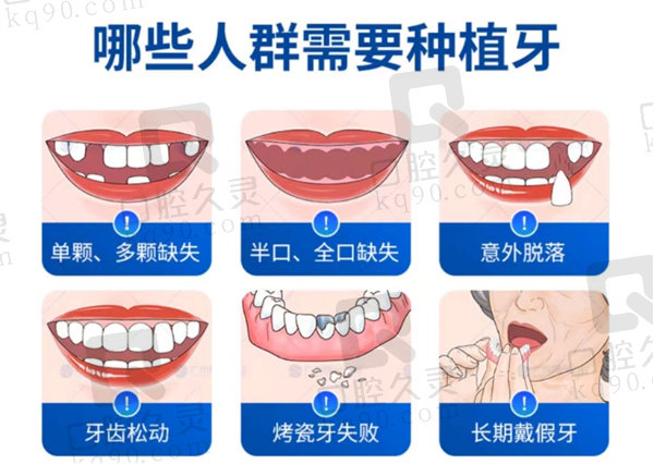 广州曙光口腔种植牙