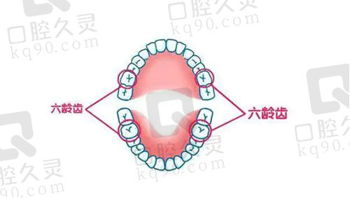六龄齿
