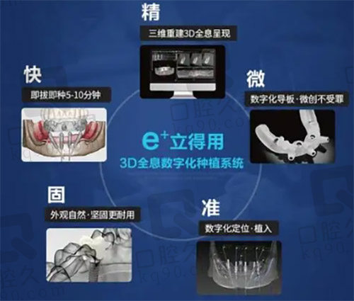 立得用种植牙技术简介