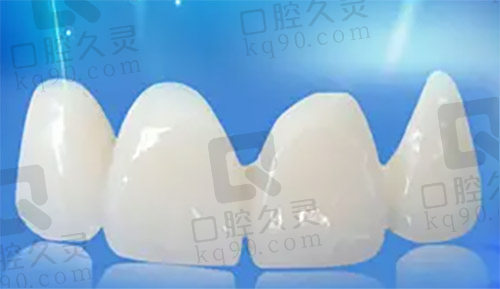全瓷冠