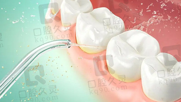 冲牙器