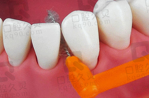 牙缝刷使用方式展示