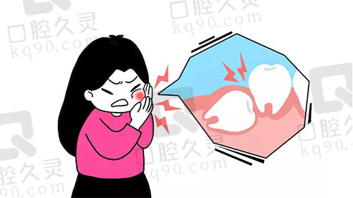 智齿冠周炎