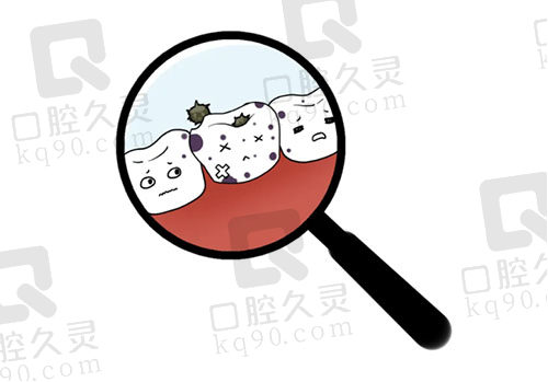 口腔检查