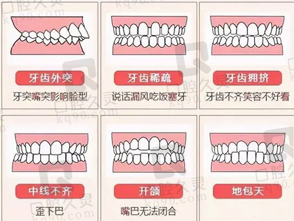 牙齿咬合不齐