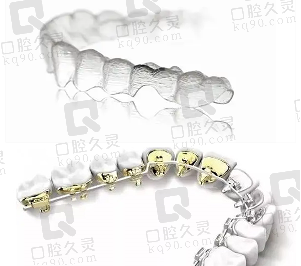 牙齿矫正