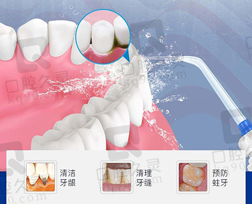 超声波洁牙