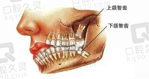 智齿