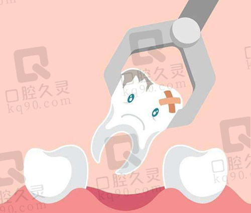 拔牙报销流程