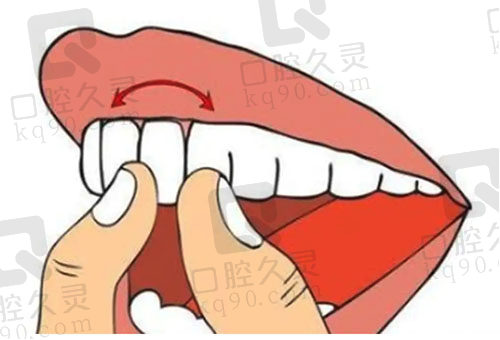 牙齿矫正后牙齿松动