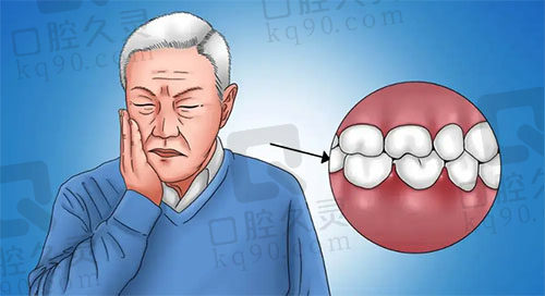 老年人牙齒痛大多數是因為什麼?