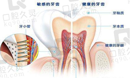 牙釉质实物图