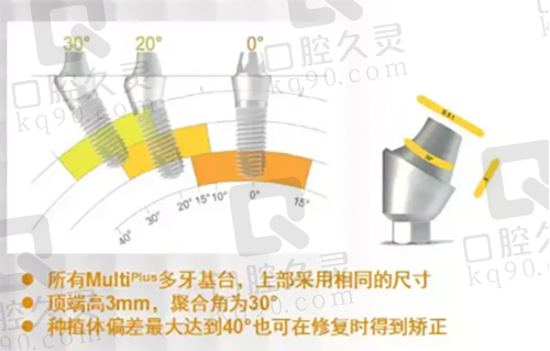 德国bego种植体优势