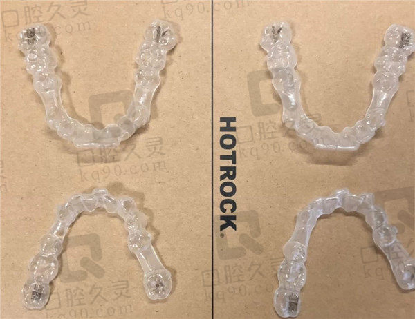 成都极光口腔牙齿矫正牙套