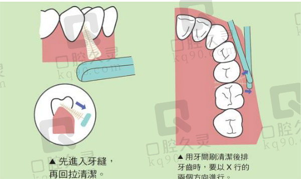 牙间隙刷