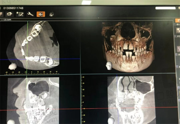 沈阳维尔口腔拍片