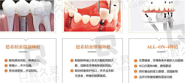 桂林美皓（美奥）口腔种植牙技术优势