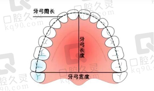 牙弓