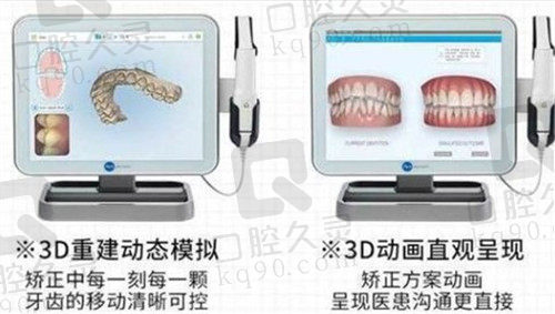 万州牙博士口腔牙齿矫正技术优势