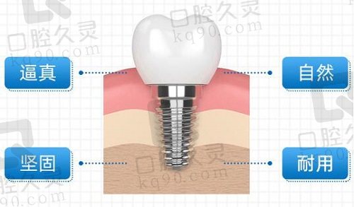 南京美奥口腔种植牙
