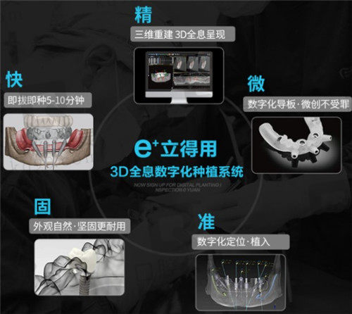 中诺口腔立得用种植牙特点