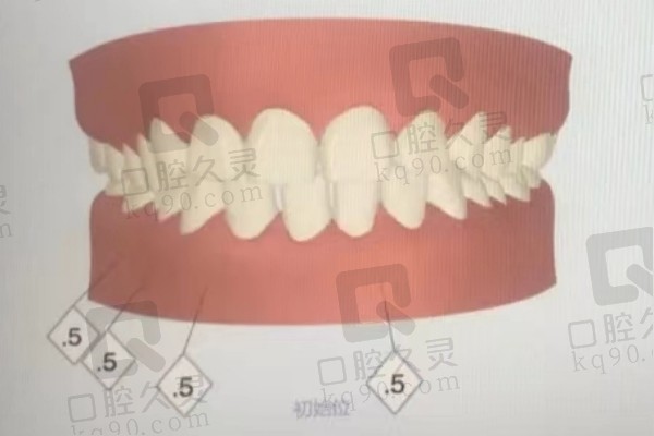 矫正方案设计