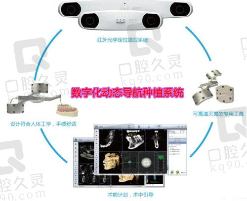 西安小白兔口腔种植牙技术先进